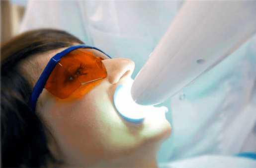 Understanding the Causes of Teeth Sensitivity Guildford