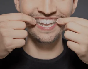 Impact of Home Kits Guildford versus Professional Teeth Whitening Treatments