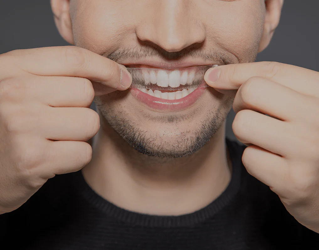 Can You Whiten Natural Teeth Without Harsh Chemicals Guildford?
