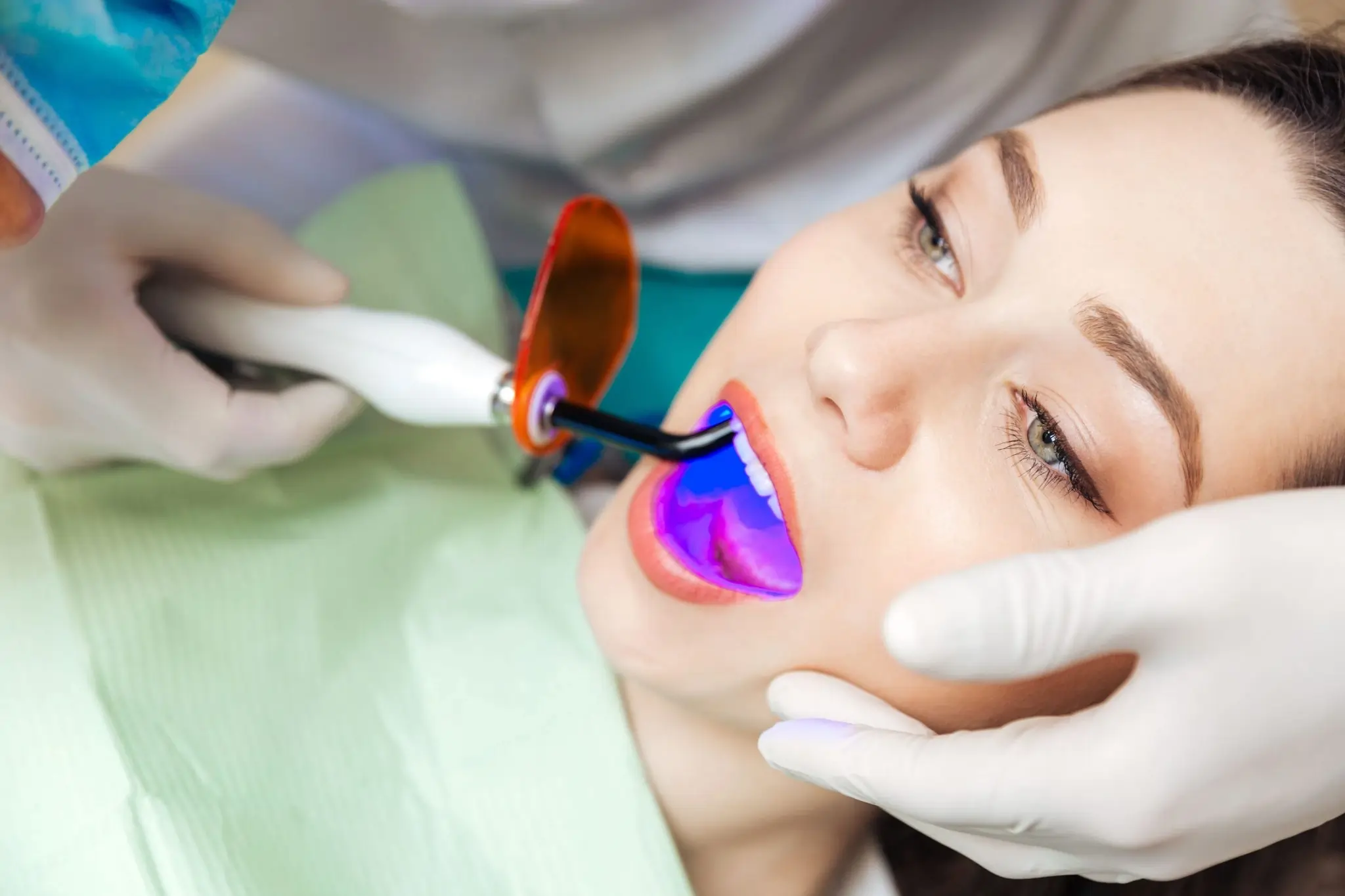 How Long Can You Expect Laser Teeth Whitening Results to Last Guildford?