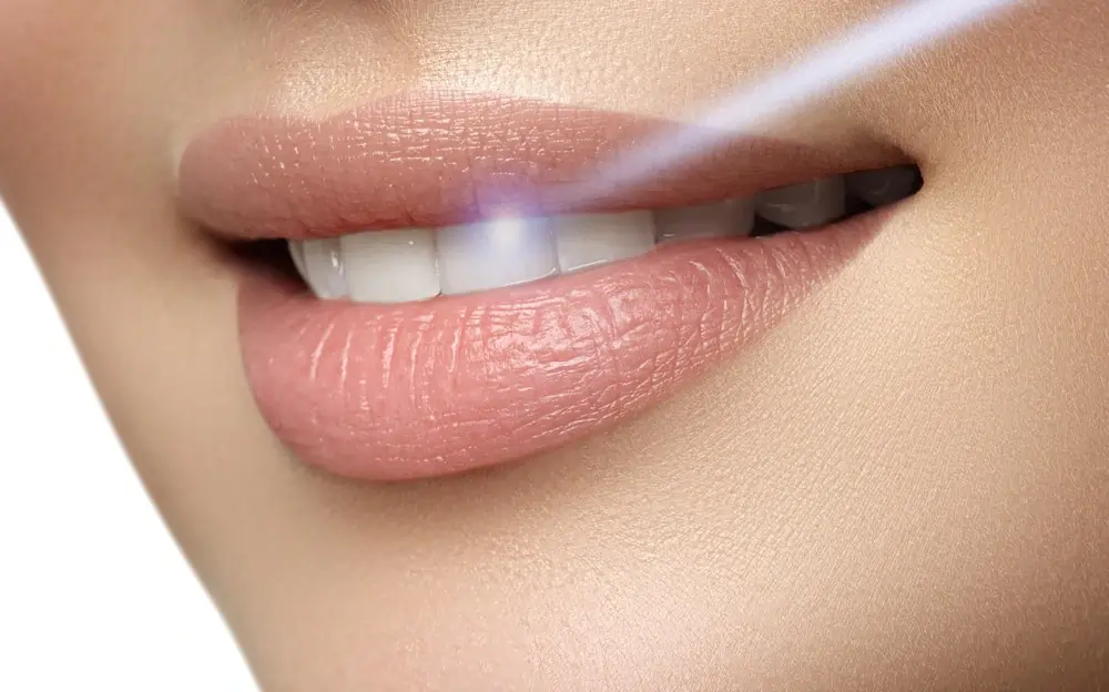 A Smarter Alternative: At-Home Laser Teeth Whitening Guildford