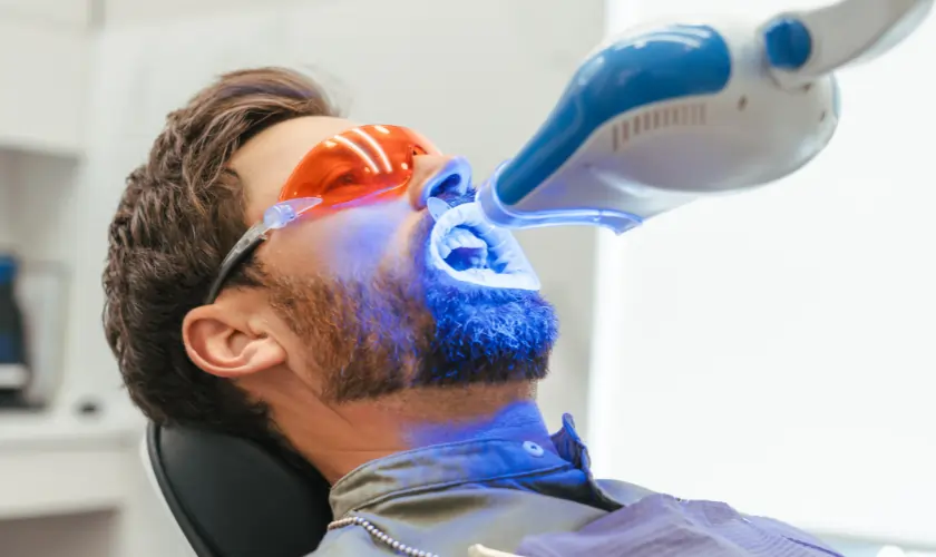 At-Home Teeth Whitening Solutions Guildford