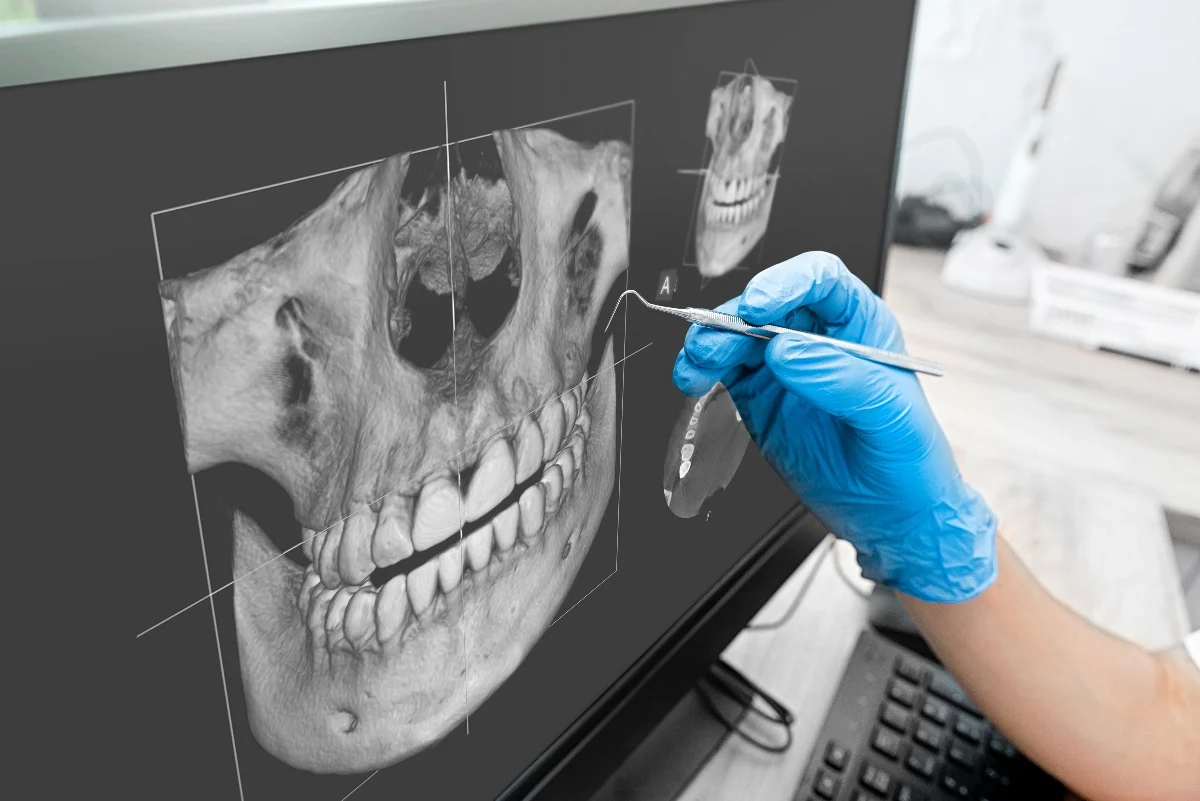 How Is AI Transforming Dental Treatment Planning Guildford?