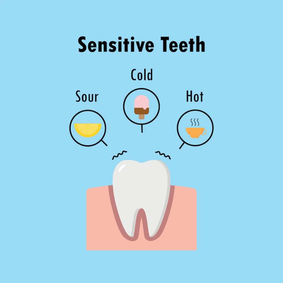 Why Do Teeth Become Sensitive After Whitening Treatments Guildford?