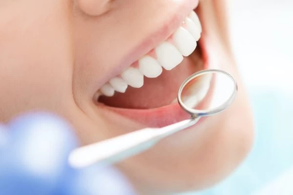 How to Maintain Your Whiter Smile After Treatment Guildford