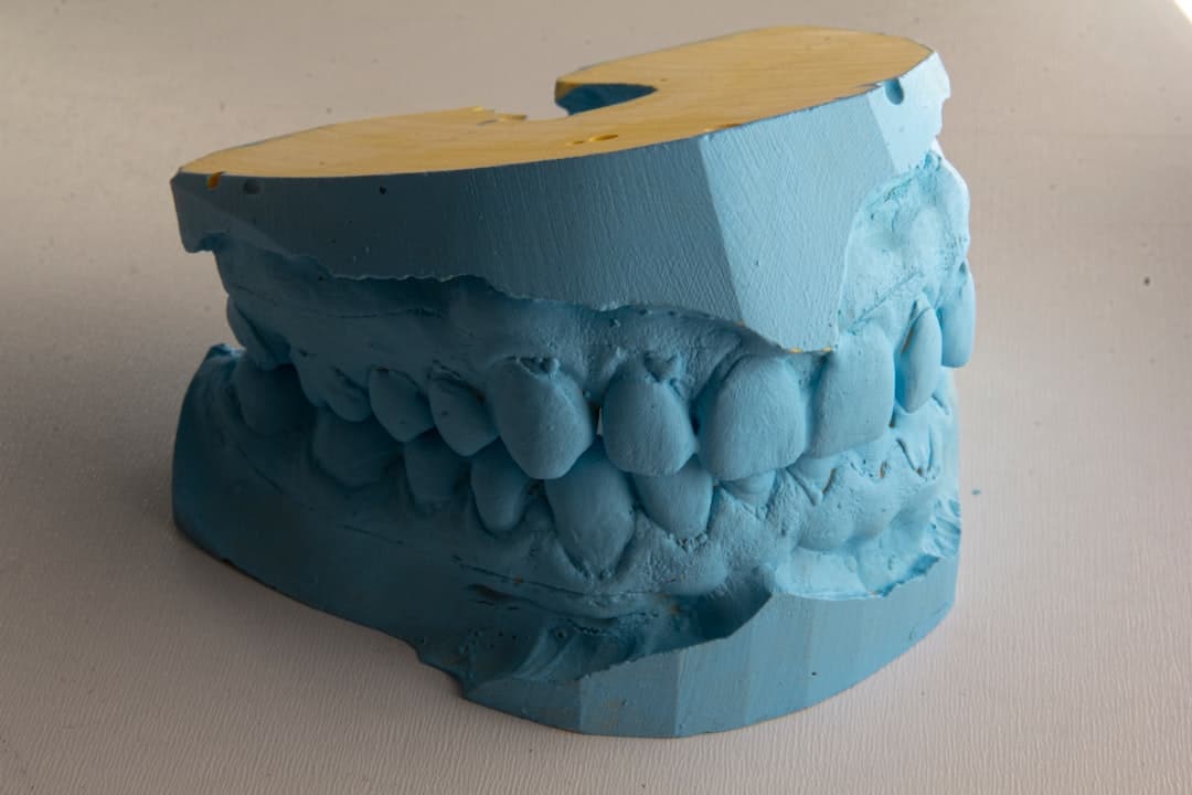How Do Dental Implants Improve Jawbone Health and Oral Function Guildford?