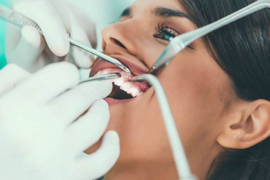 Braces Are Just for Kids – Myth or Reality Guildford