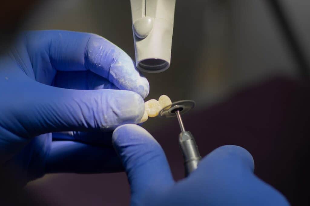 Customised Dental Solutions: Crowns, Aligners, and Implants Guildford