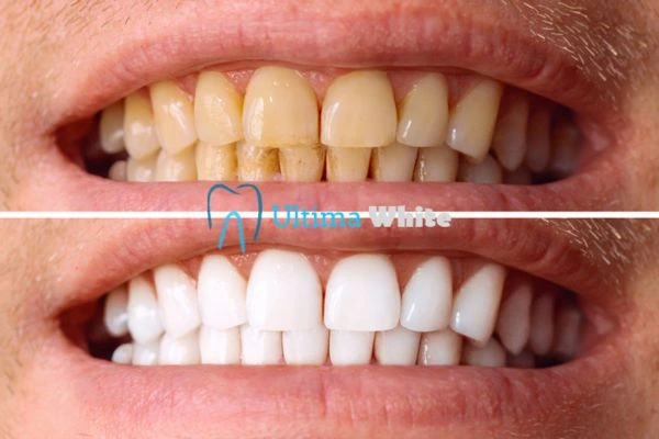 Stained Teeth and Persistent Bad Breath Guildford