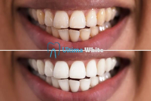 Long lasting results from Ultima White Guildford